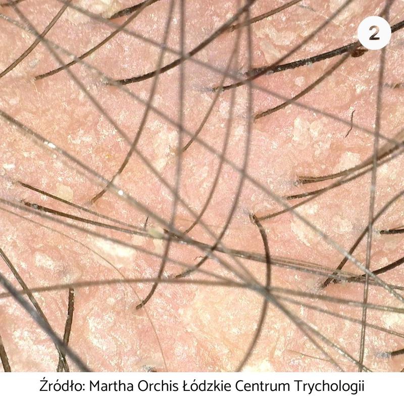 Czy jazda z otwartym oknem może wpłynąć na twoją skórę? Sprawdź to!